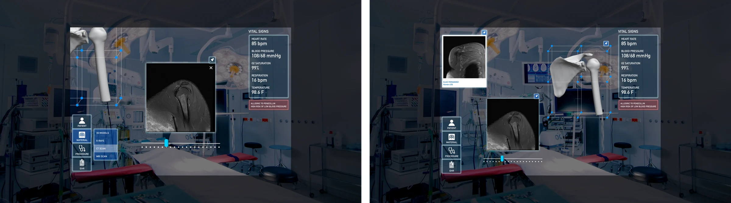 HoloLens recording and playlist access