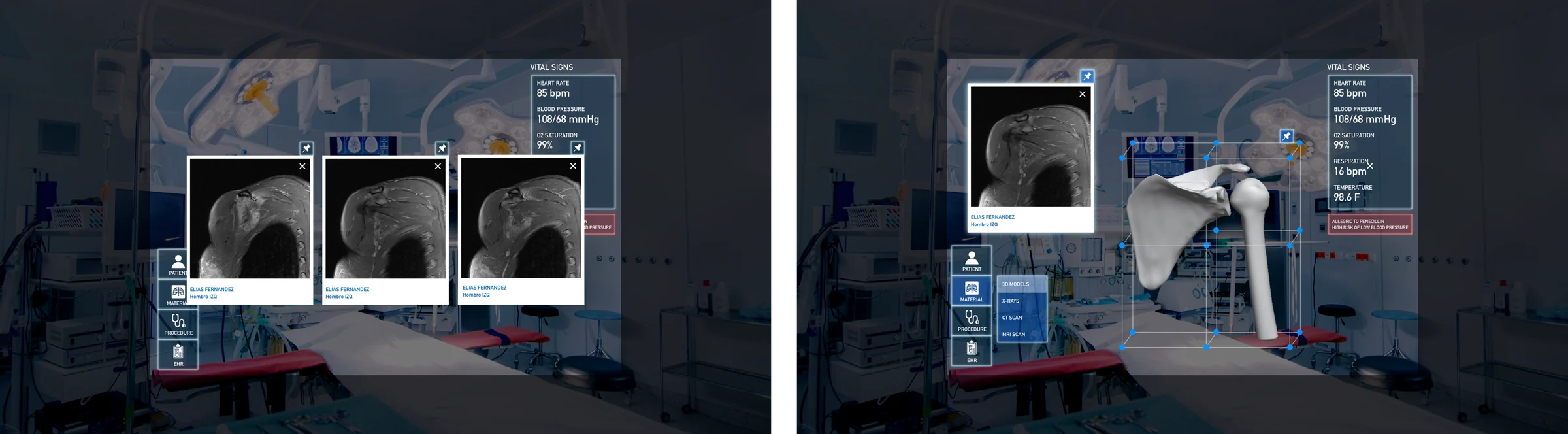 HoloLens view with patient data during surgery