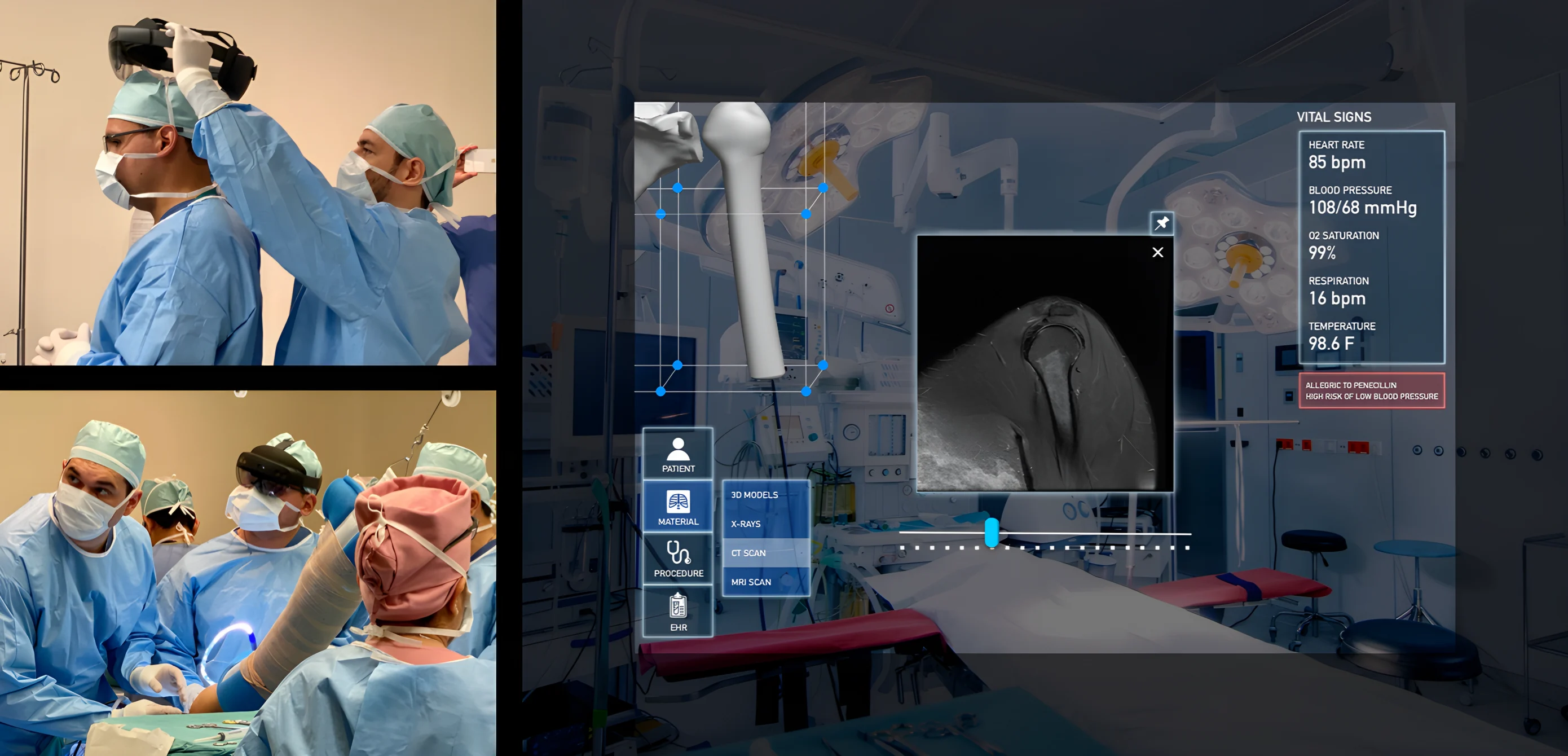 The team and the HoloLens in the operating room